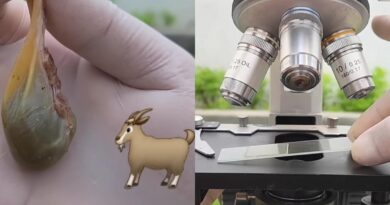 Sering dimakan mentah, beginilah penampakan empedu kambing jika dilihat dari mikroskop