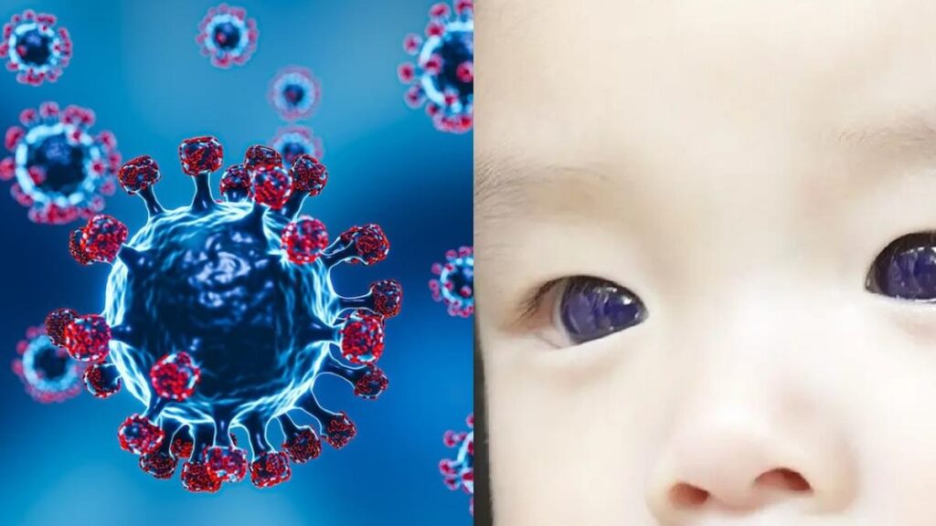 Viral, Mata Bayi di Thailand Membiru Usai Jalani Perawatan COVID-19