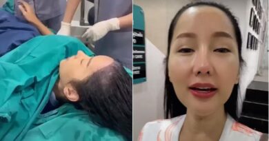6 Potret Lucinta Luna Transplantasi Rambut di Thailand, Akui Saat Botak