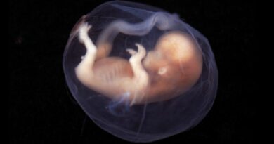 Pertama di Dunia, Ilmuwan Israel Ciptakan Model Embrio Manusia Tanpa Telur dan Sperma