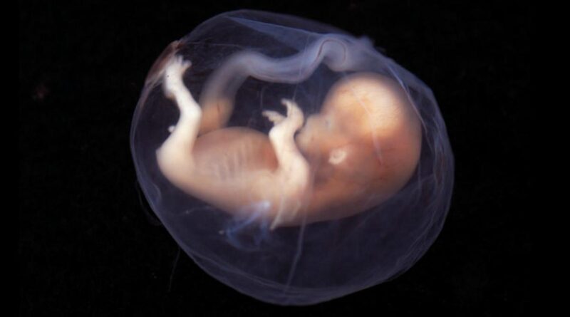 Pertama di Dunia, Ilmuwan Israel Ciptakan Model Embrio Manusia Tanpa Telur dan Sperma