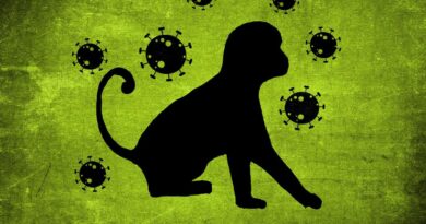 Cacar Monyet Penyakit yang Disebabkan oleh Virus Cacar Monyet, Simak Penyebab, Gejala dan Perbedaan Cacar Air