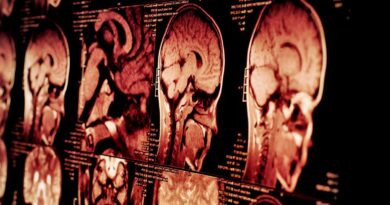 Ciri-Ciri Kanker Otak, Penyebab, Faktor Risiko, dan Pengobatannya