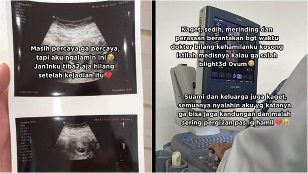 Viral, Wanita Hamil Ini Mengaku Janinnya Hilang Usai Bertemu Nenek di Maghrib