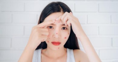 Breakout adalah iritasi kulit wajah, pahami penyebab dan cara mengatasinya