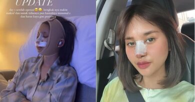 6 Potret Permesta Dhyaz Anak Farida Nurhan Kembali Operasi Hidung, Sebelumnya Sempat Infeksi