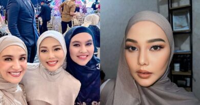 7 Potret Dara Arafah Dipikirkan Netizen untuk Operasi Dagu dan Filler, Bilang Dia Kurus