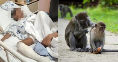 Saat bermain sendirian di luar rumah, bocah berusia 5 tahun diserang oleh lebih dari 30 ekor monyet