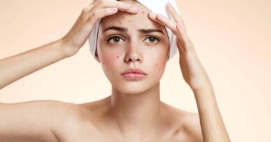 Hilangkan jerawat di wajah dengan 10 bahan alami ini, kulit akan kembali mulus dengan cepat dan aman