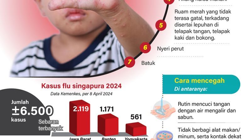 Waspadai flu Singapura setelah bepergian